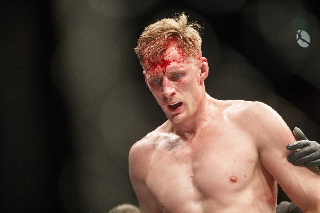 The bloody face of Alexander Volkov, in his fight against Fabrico Werdum in their Heavyweight fight during UFC Fight Night
