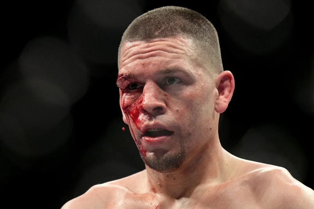 Nate Diaz’s Most Badass Moments